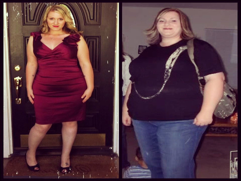 Weight Loss Surgery Before And After Pictures
 Weight Loss Surgery Before And After Nickelimages