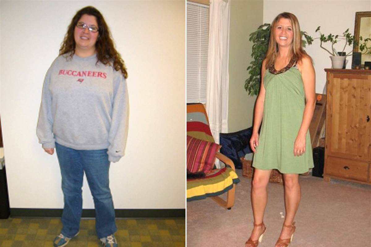 Weight Loss Surgery Before And After Pictures
 Desperate to qualify for weight loss surgery some pile on