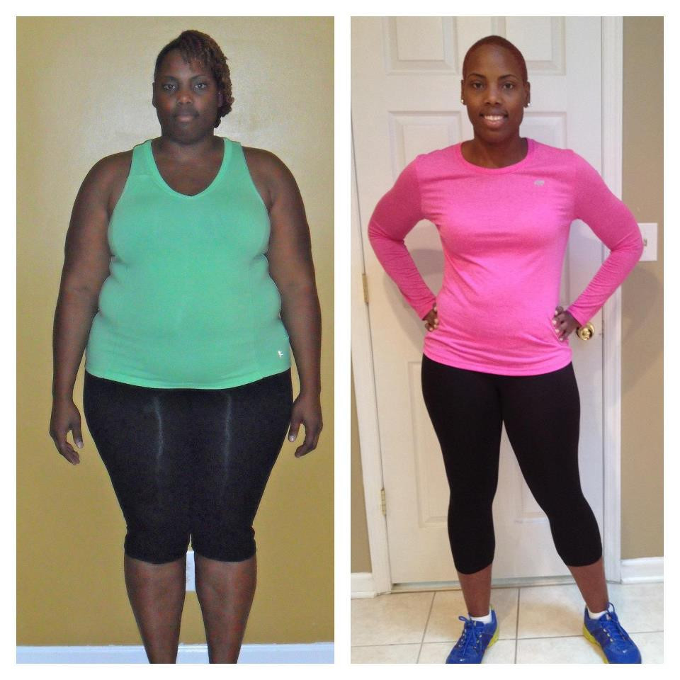 Weight Loss Surgery Before And After Success Story
 Syree has gone from 328 to 191