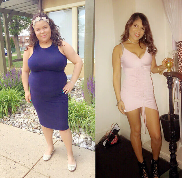 Weight Loss Surgery Before And After Success Story
 Gastric Sleeve Success Stories Freedom From Obesity