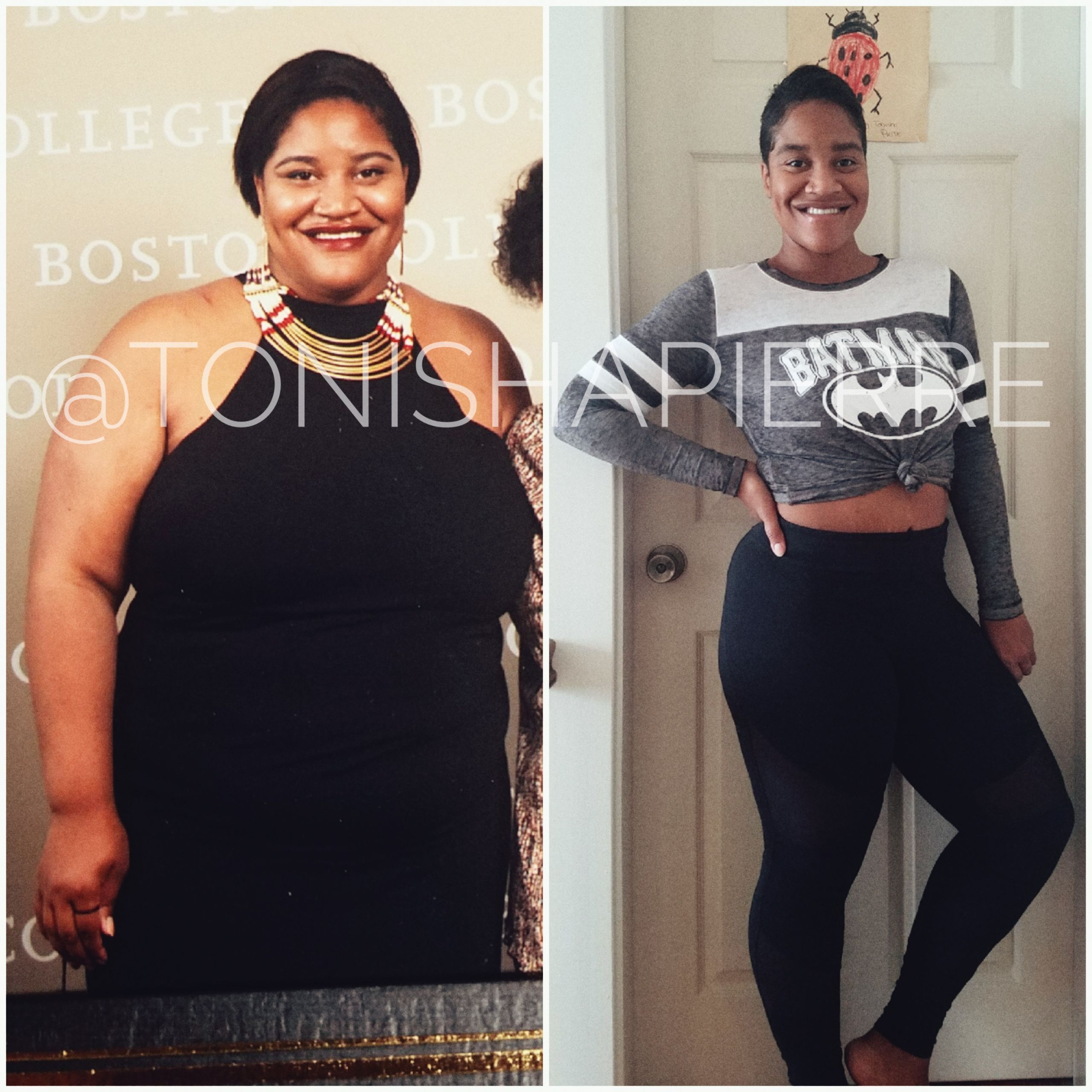 Weight Loss Surgery Before And After Success Story
 My 115 Pound Weight Loss Before and After with Gastric