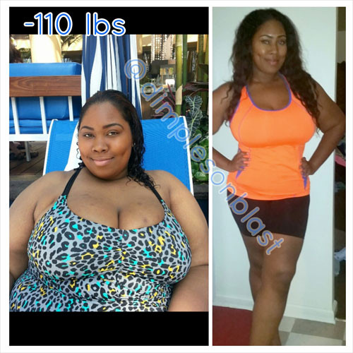 Before And After Success Story Naajma lost 110 pounds with surgery and hard...
