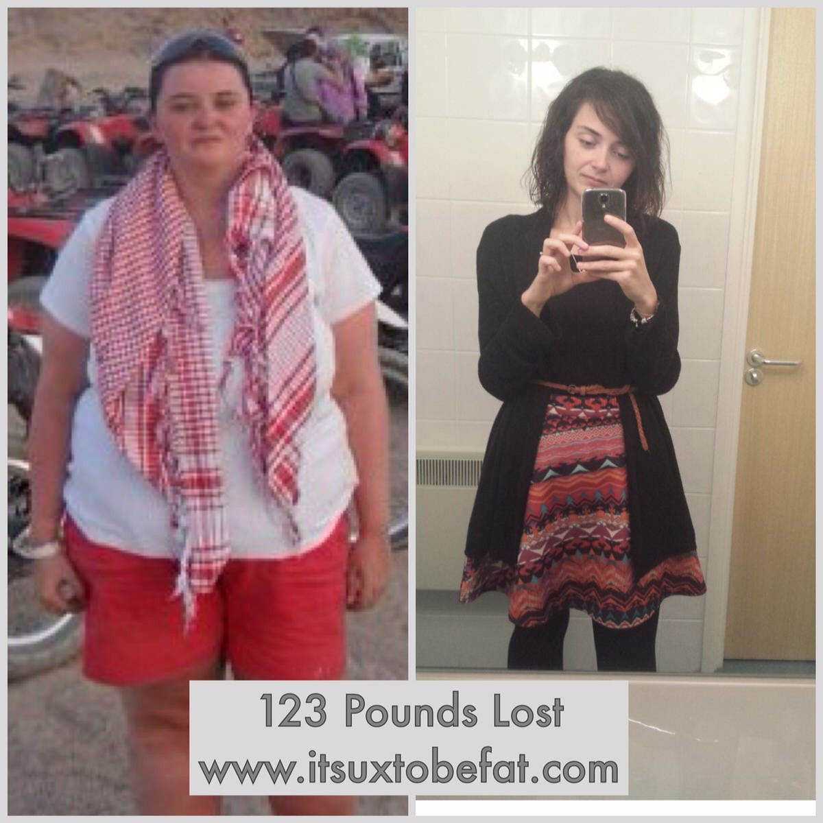 Weight Loss Surgery Before And After Success Story
 Weight Loss Success Story Laura Dryden