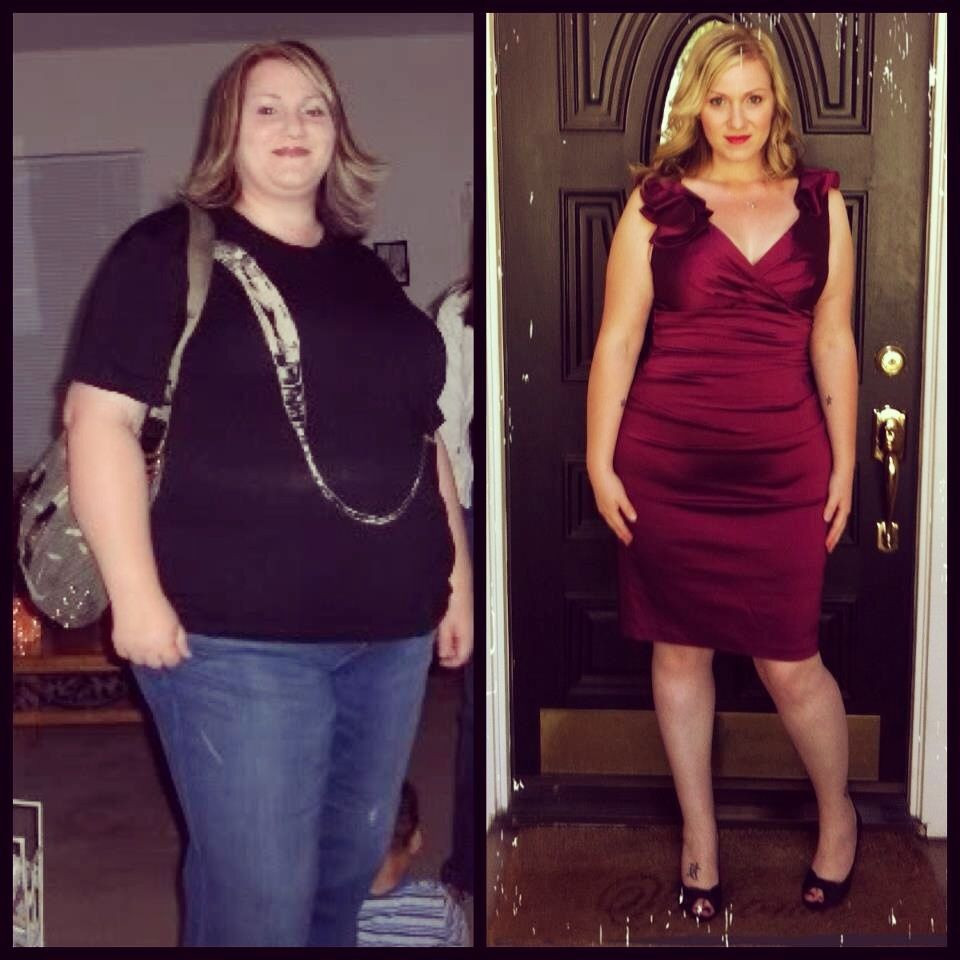 Weight Loss Surgery Before And After Success Story
 Pin on Weight Loss Surgery Before & After s