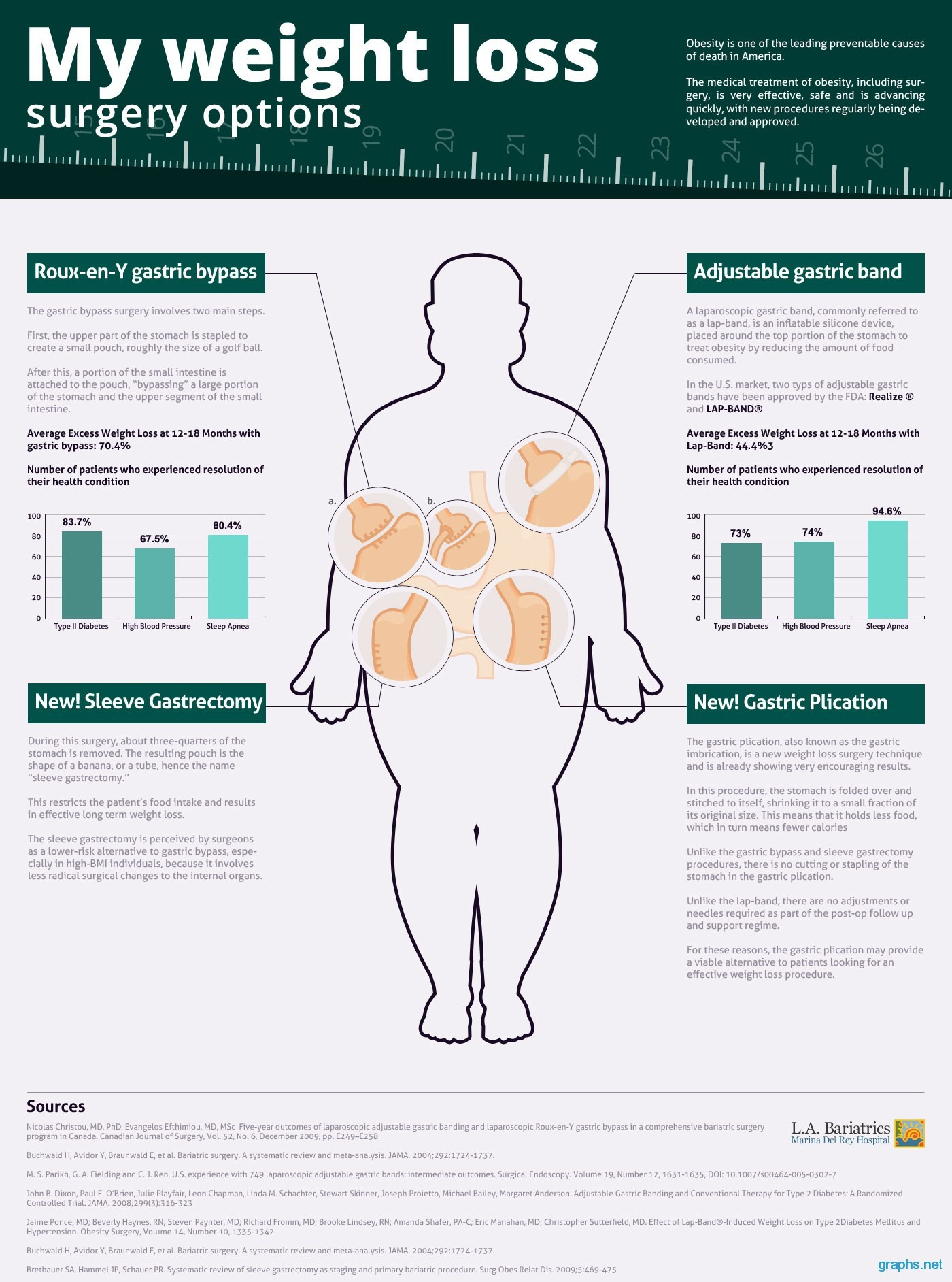 Weight Loss Surgery
 Best Weight Loss Surgery Options Chart Graph
