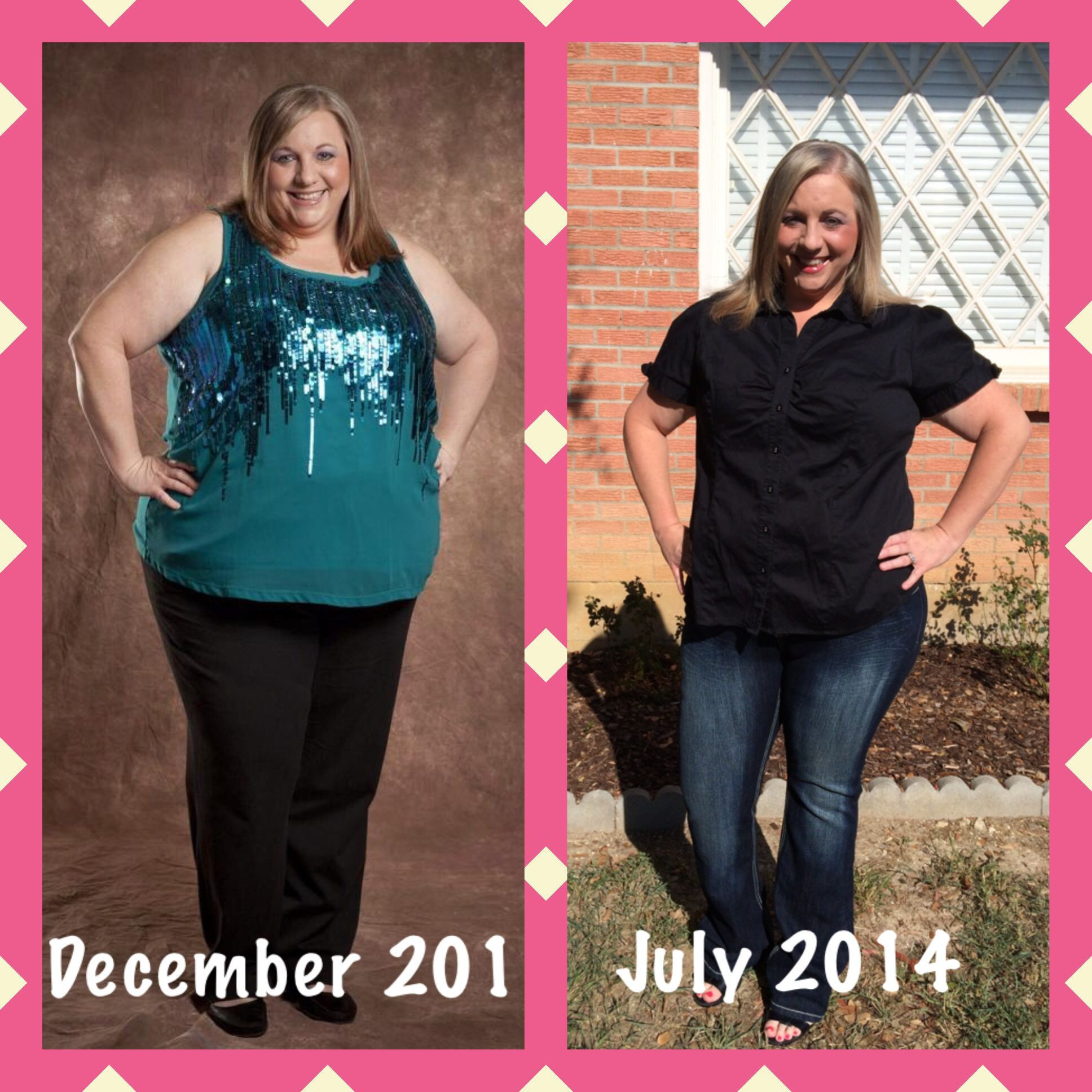 Weight Loss Surgery Sleeve Before And After
 My best before and after gastric sleeve With images