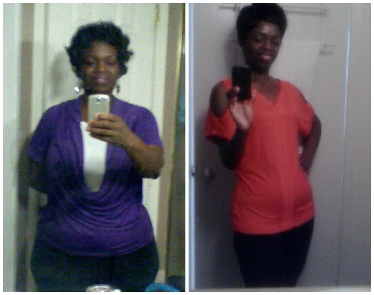 Weight Loss Surgery Sleeve
 Tonya s Successful Weight Loss Story and s