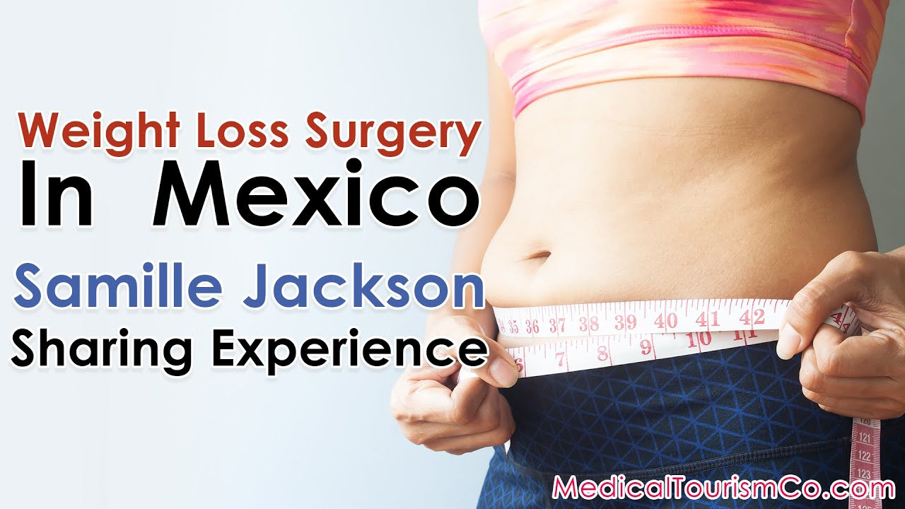 Weight Loss Surgery Tips
 Weight Loss Surgery In Mexico