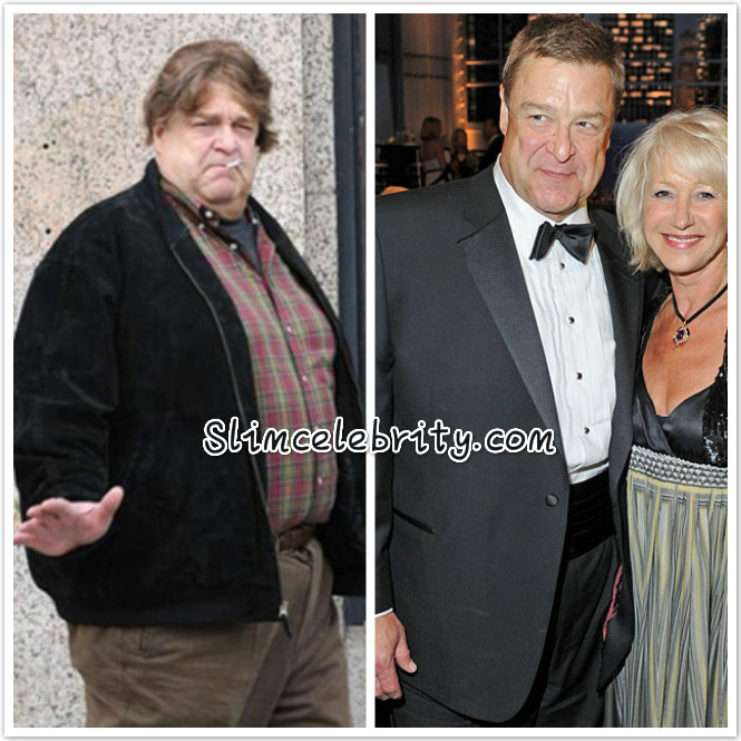 Weight Loss Surgery Tips
 John Goodman Weight Loss Tips Celebrity Weight Loss and