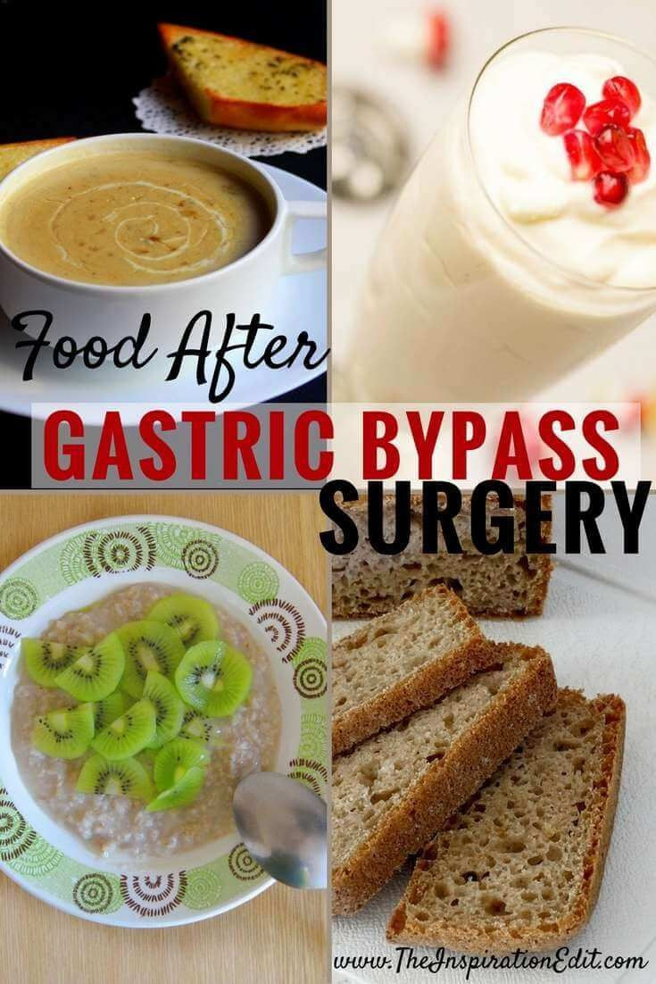 What To Eat After Weight Loss Surgery
 What To Eat After Gastric Bypass Surgery